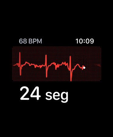 ECG app, beats per minute in top right corner, rhythm line, timer