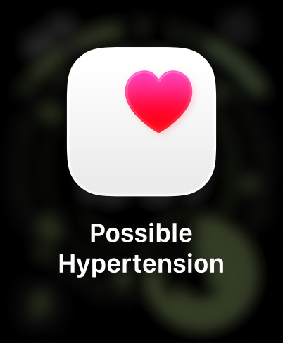 Apple Watch Ultra 3, titanium case, natural colour, heart rate notification, Trail Loop, blue/bright blue colour