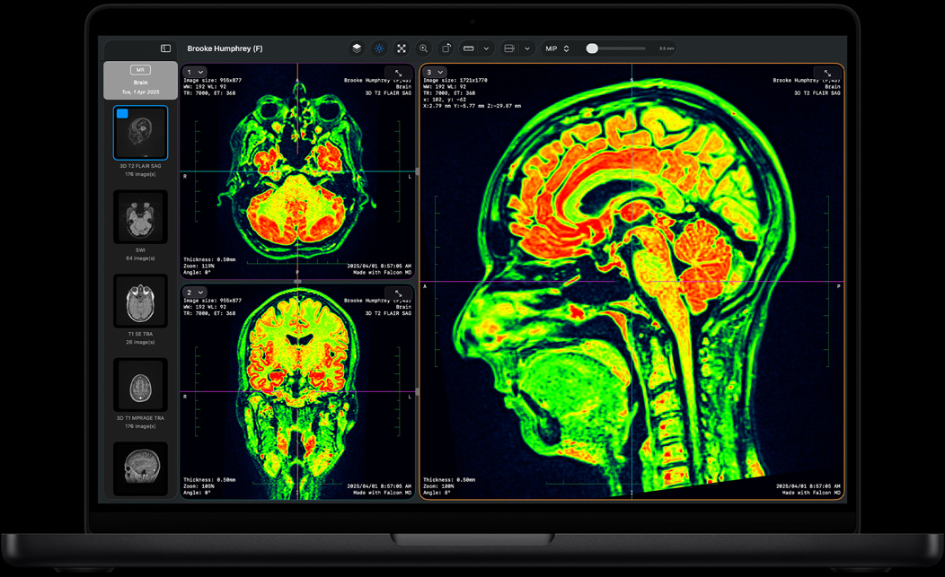 MacBook Pro ekrāns, kurā redzama Falcon MD aplikācija